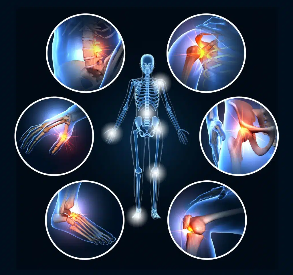 How to Manage Chronic Pain Like Fibromyalgia