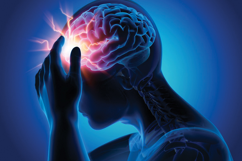 Recognizing and Treating Acute Brain Attacks